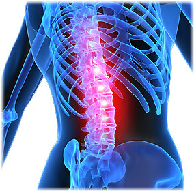 img-back-pain-front